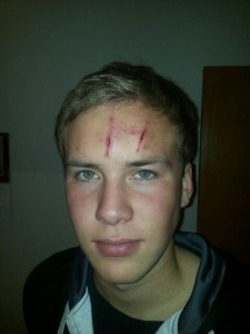 Fannar illa leikinn eftir Keflvíkinga